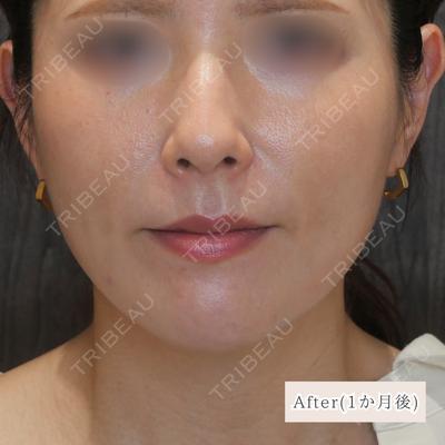 CLEAN BEAUTY CLINIC TokyoAzabu 三田 亜耶医師の症例