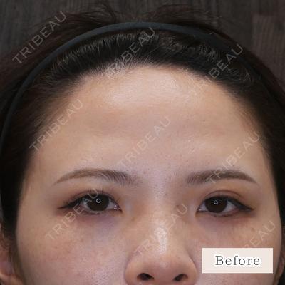 CLEAN BEAUTY CLINIC TokyoAzabu 三田 亜耶医師の症例