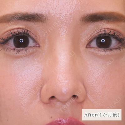 CLEAN BEAUTY CLINIC TokyoAzabu 三田 亜耶医師の症例