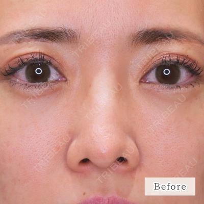 CLEAN BEAUTY CLINIC TokyoAzabu 三田 亜耶医師の症例
