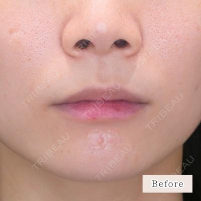 CLEAN BEAUTY CLINIC TokyoAzabu 三田 亜耶医師の症例