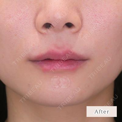 CLEAN BEAUTY CLINIC TokyoAzabu 三田 亜耶医師の症例