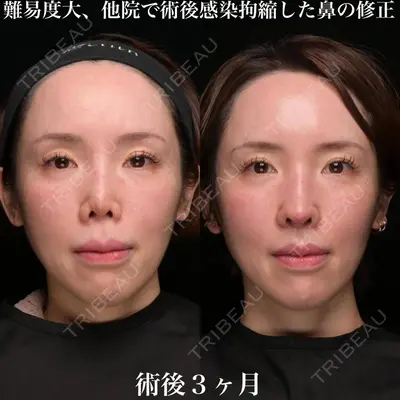 Zetith Beauty Clinic 銀座院 鉄 鑠医師の症例