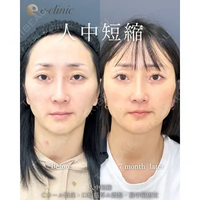 eクリニック 福岡院 伊藤 渉医師の症例