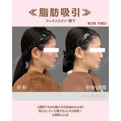 CHARIS BEAUTY CLINICの症例