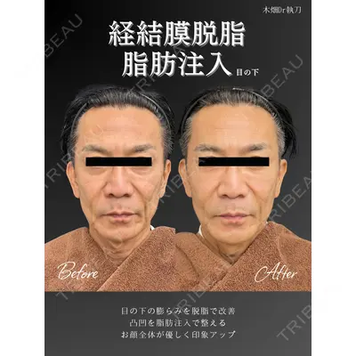 CHARIS BEAUTY CLINICの症例