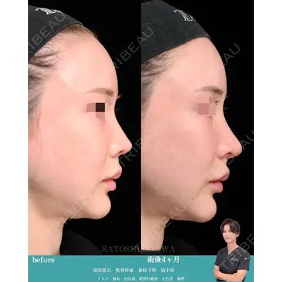 Zetith Beauty Clinic 大阪心斎橋院の症例