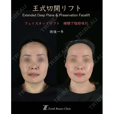 Zetith Beauty Clinic 新宿院 王 蘇医師の症例