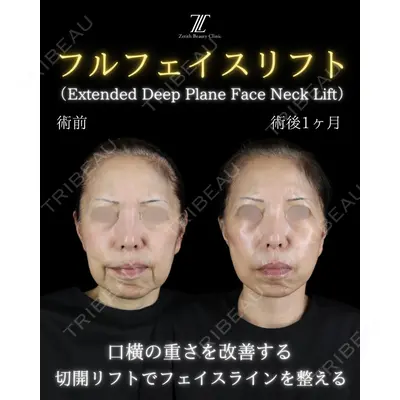 Zetith Beauty Clinic 新宿院 副島直人医師の症例