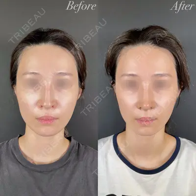 R Beauty CLINIC 大阪院 小池 泰弘医師の症例