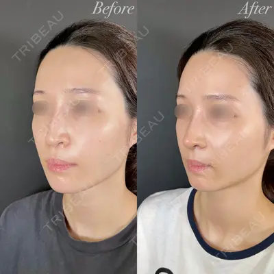 R Beauty CLINIC 大阪院 小池 泰弘医師の症例