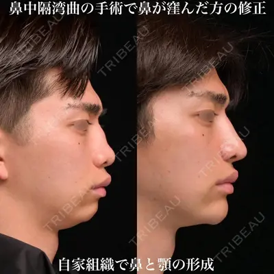 Zetith Beauty Clinic 銀座院 鉄 鑠医師の症例