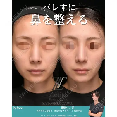 Zetith Beauty Clinic 銀座院 小川 悟史医師の症例