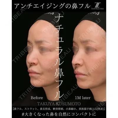 Zetith Beauty Clinic 大阪心斎橋院 楠本 拓哉医師の症例