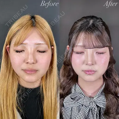 R Beauty CLINIC 大阪院 小池 泰弘医師の症例