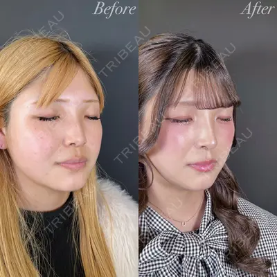 R Beauty CLINIC 大阪院 小池 泰弘医師の症例