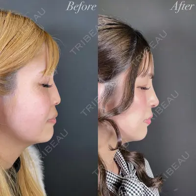R Beauty CLINIC 大阪院 小池 泰弘医師の症例