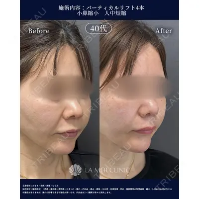 LA MER CLINIC 辻 航平医師の症例