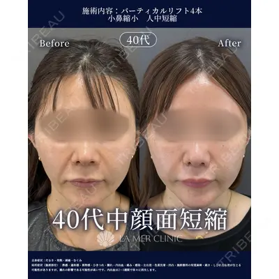 LA MER CLINIC 辻 航平医師の症例