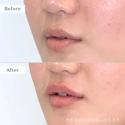 nico wellness デンタルクリニック広尾 佐藤 大晟医師の症例
