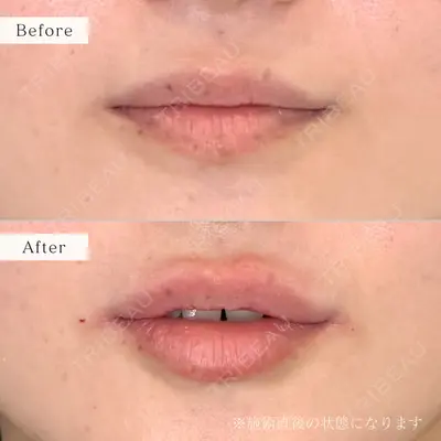 nico wellness デンタルクリニック広尾 佐藤 大晟医師の症例