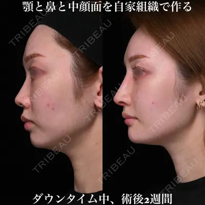 Zetith Beauty Clinic 銀座院 鉄 鑠医師の症例