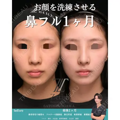 Zetith Beauty Clinic 銀座院 小川 悟史医師の症例