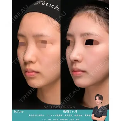 Zetith Beauty Clinic 銀座院 小川 悟史医師の症例