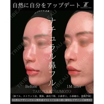 Zetith Beauty Clinic 大阪心斎橋院 楠本 拓哉医師の症例
