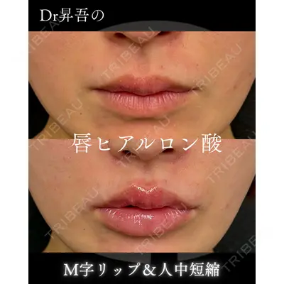 銀座美容クリニック 南草津院 廣瀨 昇吾医師の症例