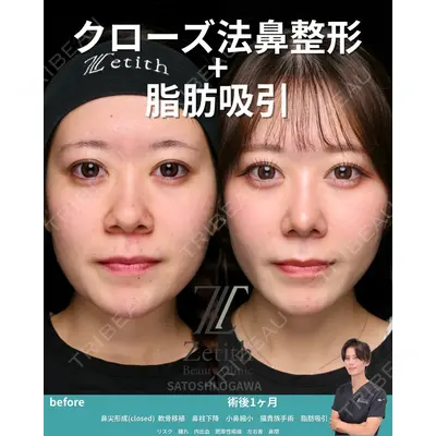 Zetith Beauty Clinic 銀座院 小川 悟史医師の症例
