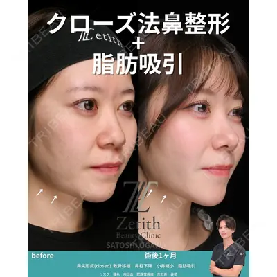 Zetith Beauty Clinic 銀座院 小川 悟史医師の症例