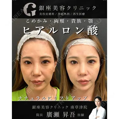 銀座美容クリニック 南草津院 廣瀨 昇吾医師の症例