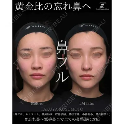 Zetith Beauty Clinic 大阪心斎橋院 楠本 拓哉医師の症例