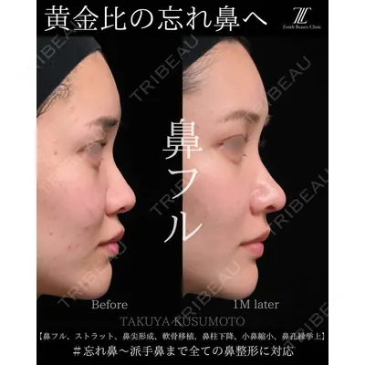 Zetith Beauty Clinic 大阪心斎橋院 楠本 拓哉医師の症例