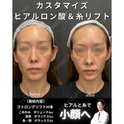 銀座美容クリニック 南草津院 廣瀨 昇吾医師の症例