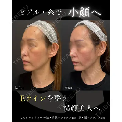 銀座美容クリニック 南草津院 廣瀨 昇吾医師の症例