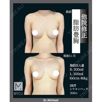 MYCLI【マイクリ】東京・恵比寿院 本田マイケル武史医師の症例