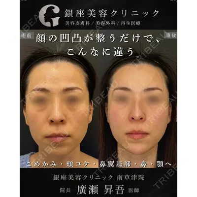 銀座美容クリニック 南草津院 廣瀨 昇吾医師の症例