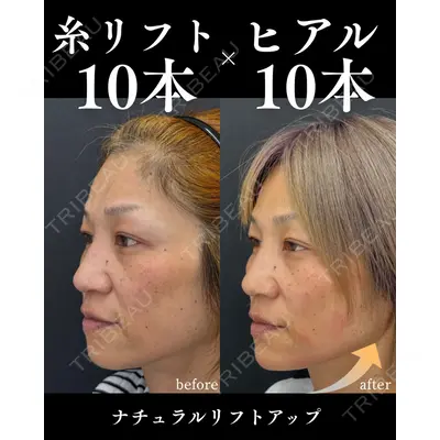 銀座美容クリニック 南草津院 廣瀨 昇吾医師の症例