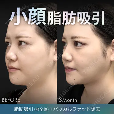 ジョウクリニック 銀座院 重本　譲医師の症例