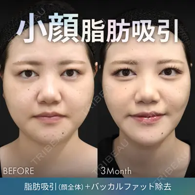 ジョウクリニック 銀座院 重本　譲医師の症例