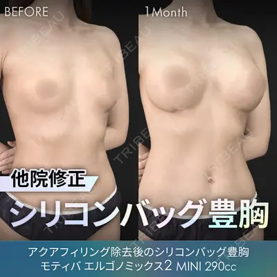 ジョウクリニック 銀座院 重本　譲医師の症例
