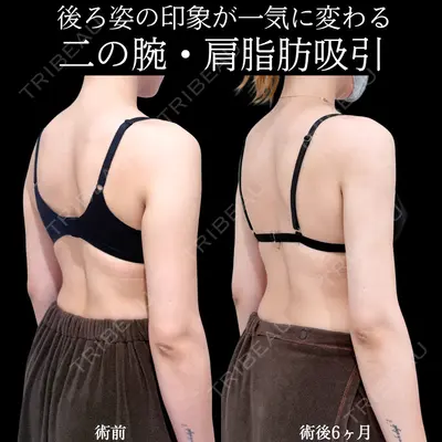 アリエル美容クリニック 横浜院 加藤 敏次医師の症例