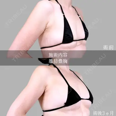 アリエル美容クリニック 横浜院 加藤 敏次医師の症例