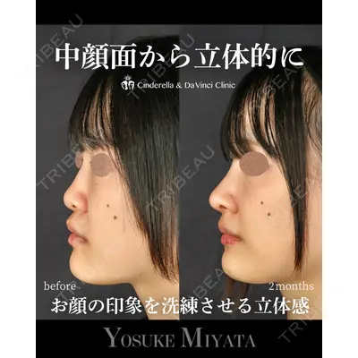 シンデレラ＆ダヴィンチクリニック 宮田 洋佑医師の症例