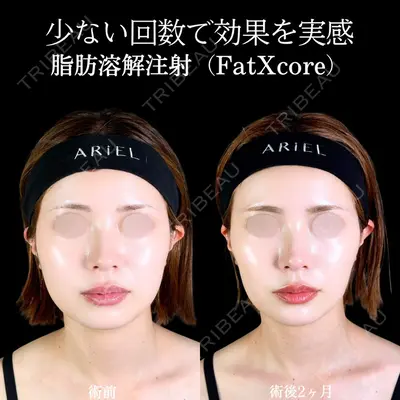アリエル美容クリニック 郡山院 安齋 誠基医師の症例