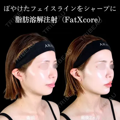 アリエル美容クリニック 郡山院 安齋 誠基医師の症例