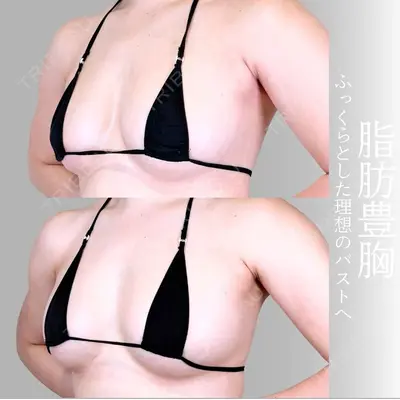アリエル美容クリニック 横浜院 加藤 敏次医師の症例