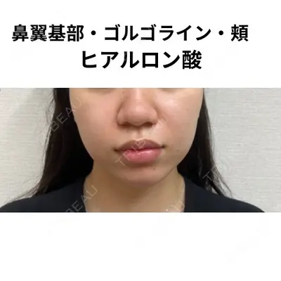 おおたかの森ビューティークリニック 海野 芙美香医師の症例